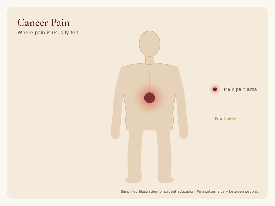 Body diagram showing where cancer pain pain is usually felt