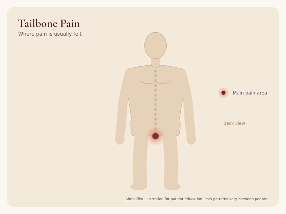 Tailbone Pain: pain area Body diagram showing where tailbone pain pain is usually felt