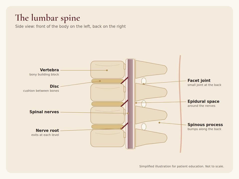 The lumbar spine Side view of the lumbar spine showing vertebrae, discs, spinal nerves, nerve roots, facet joints and the epidural space