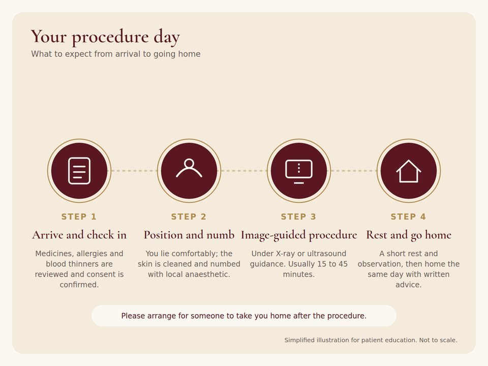 Four-step infographic of a procedure day: check in, position and numb, image-guided procedure, rest and go home